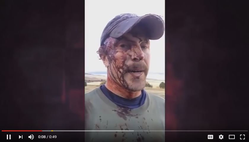 Man Survives a Bear Attack [VIDEO]